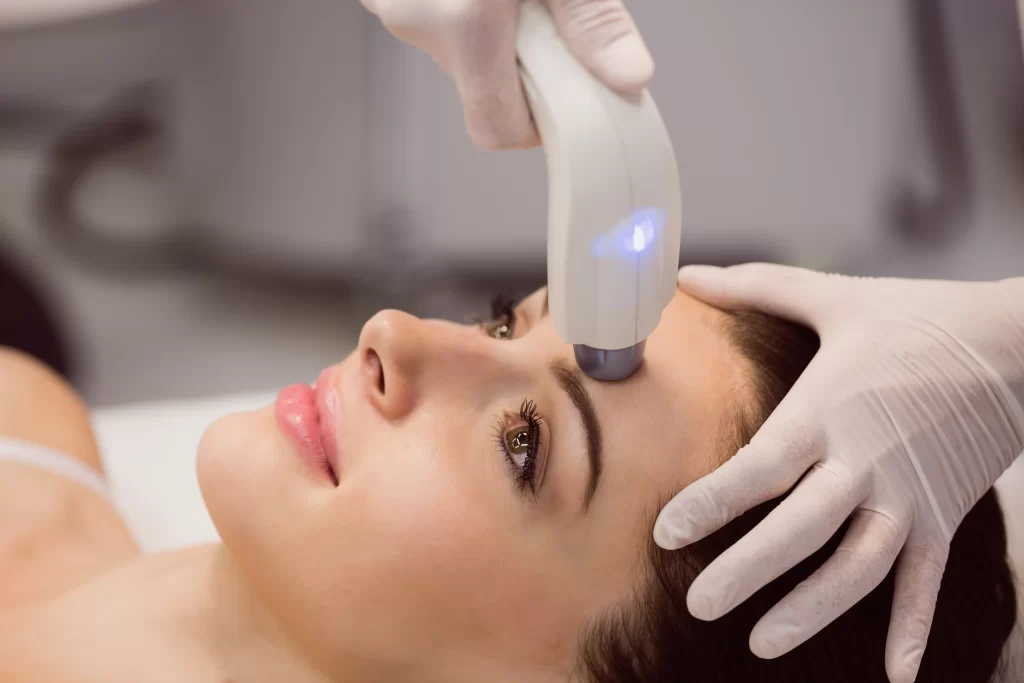CO₂ Laser Treatment